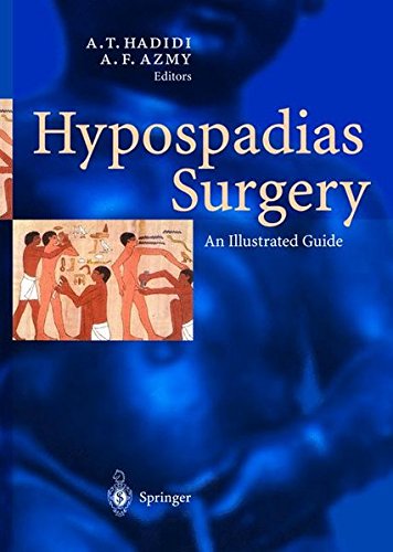 Preisvergleich Produktbild Hypospadias Surgery: An Illustrated Guide