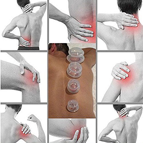 Silikon Schröpfen Set mit Schröpfen Buch – 5 Cup Professionelle Schröpfen Massage Kit für Muskel Schmerzen, Schmerzlinderung, Verletzung Recovery, Toning & Cellulite, Gewichtsverlust - 4