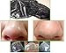 Black Forest Spa® Acne Blackhead Killer Anti Acne Facial Mask Peel Off Mask 10pcs Pack 10x6ml