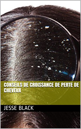 Download Conseils de croissance de perte de cheveux Download Conseils de croissance de perte de cheveux