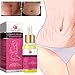 Price comparison product image Ouneed- 30MLNatural Chinese herbal Essential Oil For Removal Scar Stretch Mark Essential Oil Fat Scar Striae Gravidarum Treatment