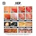Koi Beauty 10 pcs 12 Tips Bayonet Coupling Needle Catridge for Micro Needle Derma Pen
