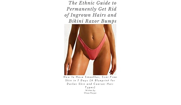 The Ethnic Guide To Permanently Get Rid Of Ingrown Hairs And