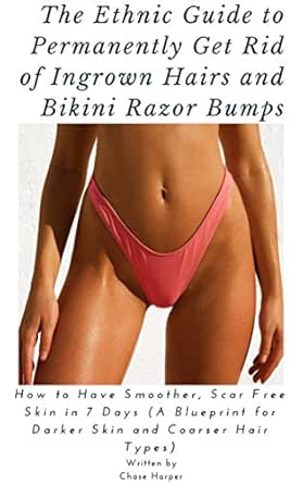 The Ethnic Guide To Permanently Get Rid Of Ingrown Hairs And