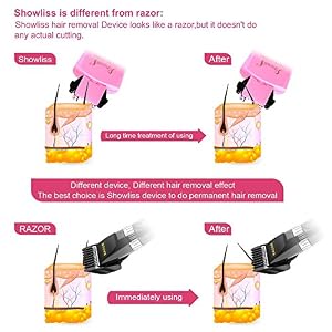 Blackhead Remover (Pink) - Image 8