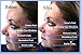 Amazing Miracle Ceferulichyaluronic Hyaluronic Anti Ageing Vitamin Minute Serum anti aging moisturizer cream Anti aging night cream Anti Aging Night Anti Aging anti aging moisturizer tightening serum eye miracle