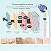 Prime Day Deal Blackhead Remover, Baseus Facial Pore Cleanser Electric Blackhead Vacuum Suction Removal No Bruising, Acne Extractor Tool Set, Comedo Microdermabrasion Exfoliating Machine for Women and Men