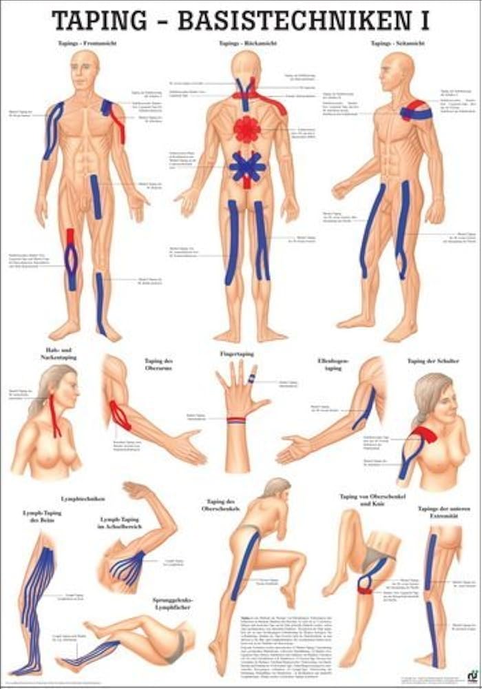 Тейп для похудения живота схемы. Учебные плакаты по массажу.