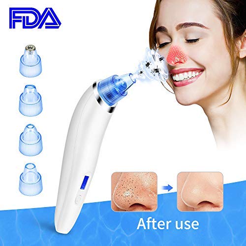 Removedor de puntos negros, aspiradora eléctrica recargable por USB, removedor de succión de puntos negros con pantalla LED, limpiador de poros de piel con 4 cabezales de succión reemplazables por