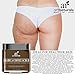 Art Naturals Organic Arabica Coffee Scrub 8.8 oz - The Most Powerful Remedy for Varicose Veins, Cellulite, Stretch Marks, Eczema & Acne - Deep Skin Exfoliator That Promotes Cell Repair & Rejuvenation
