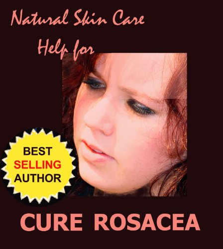 Cure Rosacea - New Information, Help and Hope for Adult Acne (Natural Skin Care Book 1) (English Edition) livre