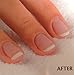 Vitry Nail Repair Treatment