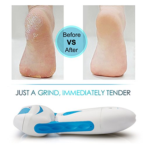 rantizon Hornhautentferner elektrisch Fuß Pediküre Hornhautentferner wiederaufladbar Pediküre Fuß Datei für trockene/Harte/Dead creaked Haut an Füße Fuß Spa at Home Foot Repair mit gratis Extra Roller Head - 3