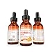 25% VITAMIN C SERUM 15ml - A POWERFUL ADVANCED FORMULA - Hyaluronic Acid, Retinol, Vitamin E and Rosehip & Jojoba Oil Blend. Best anti-ageing serum for the face - promotes the skin's natural defences, replaces lost moisture and dramatically reduces fine lines and wrinkles. A natural blend of clinically proven ingredients. Firmer, softer healthier looking skin...