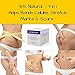 Naturology Stretch Mark, Cellulite & Scar Removal 3-1 Cream with Retinol. 98% Natural treatment targets your problem areas, toning and firming your legs, arms, stomach and buttocks, our advanced formula contains the best organic anti-oxidant ingredients available, developed to be soothing, delicate yet powerful. Use this lotion on it's own or with your massager, brush, scrub, or roller. Works quickly to hydrate, repair & restore your skins softness & suppleness.