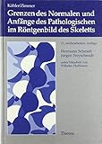 Image de Grenzen des Normalen und Anfänge des Pathologischen im Röntgenbild des Skeletts