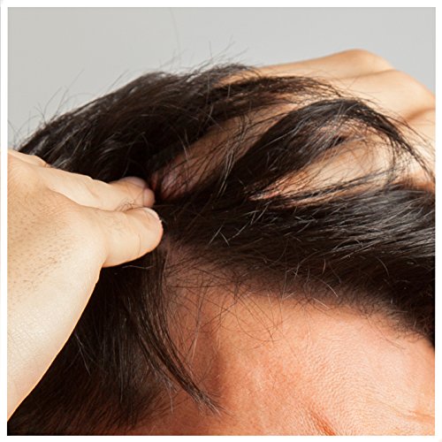 -26g- IMPERIO STREUHAAR zur HAARVERDICHTUNG & VOLLEM HAAR in Sekunden. SCHÜTTHAAR-100% Natur! (DUNKELBRAUN) - 5