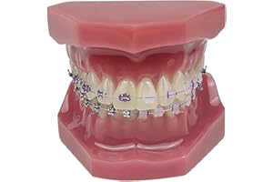 Modello ortodontico, YOUYA DENTAL 1/4 Confronto autobloccante in metallo Modello ortodontico Modello di dente ortodontico Modello di denti per l'insegnamento dentale Modello