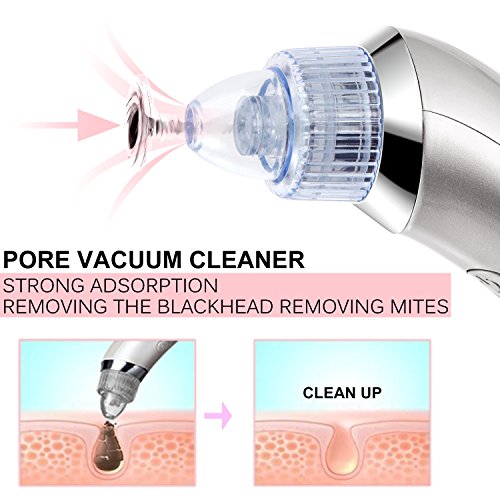 Mitesser Entferner Set, iSuri Mitesser Reiniger Elektrisch Vakuum Nase Mitesserentferner Sauger Akne Entferner Gerät Poren Reiniger mit 4 Austauschbaren Reinigungsaufsätzen (Weiß) - 4