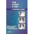 Amazon.fr - The Chest X-Ray: A Survival Guide - de Lacey MA FRCR ...