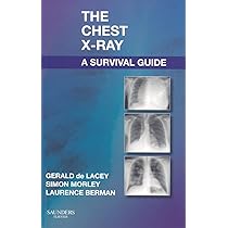 健康+医学 SAUNDERS ELSEVIER Accident &amp; Emergency Radiology A SURVIVAL GUIDE Third Edition 2015 020SaD Accident & Emergency Radiology | ScienceDirect