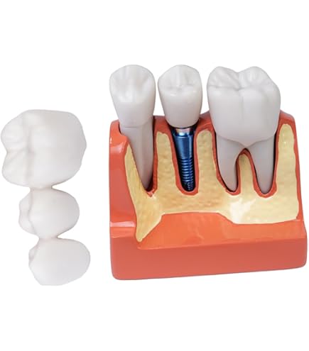 Akyol - Tandarts Sleutelhanger - Tandarts - De Beste Tandarts Tandartsen Dentist Arts Tanden Tand Specialist In Tandheelkunde Tandartsassistente Mondhygienist Tandartspraktijk 4 X 7 5 Cm
