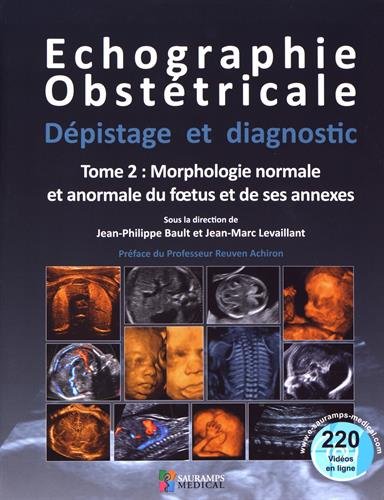 Download Echographie obstétricale, dépistage et diagnostic : Tome 2, Morphologie normale et anormale du foetus et de ses annexes Download Echographie obstétricale, dépistage et diagnostic : Tome 2, Morphologie normale et anormale du foetus et de ses annexes