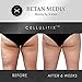 Anti Cellulite Treatment Cream & Massager: Cellulitix Cellulite Remover for Thighs & Buttocks with Adiposlim & Caffeine - Thigh & Buttock Skin Tightening, Firming Lotion for Cellulite Reduction: 100mL