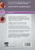 Image de Esofagitis Eosinofílica