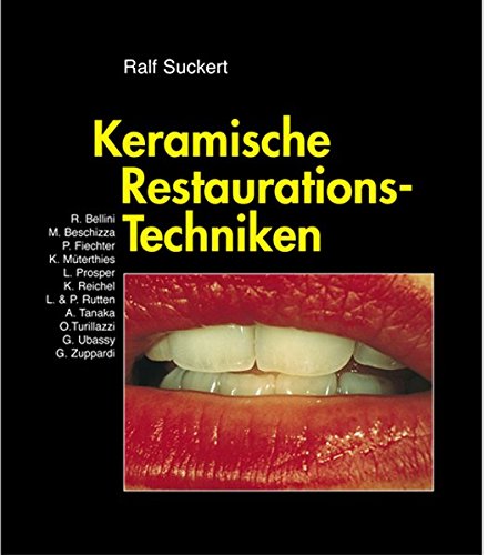 Download Keramische Restaurations-Techniken (Livre en allemand) Download Keramische Restaurations-Techniken (Livre en allemand)