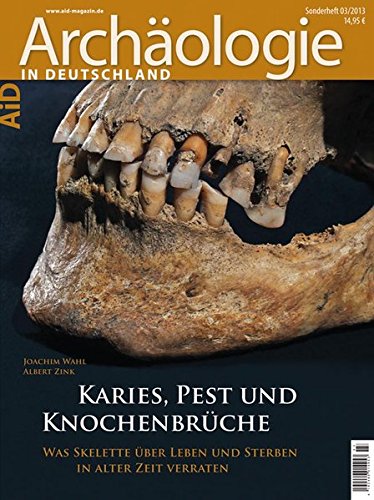 Karies, Pest und Knochenbrüche