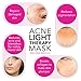 JoLee LED Acne Light Therapy Acne Mask Most Advanced Light Technology [UNLIMITED USES with No Need to Purchase Activators] for Treatment of Mild-to-Moderate Acne, Spots, Blackheads, Skin Blemishes and Reduces the Appearance of Breakouts, Combats Inflammation and Bacteria to Reveal Rejuvenated, Revitalised and Refreshed Clear Skin – Clinically Proven to Achieve Visible Results in as Little as 2 Weeks – The Scientific Alternative to Acne Cream – Comes with Full 12 Months Warranty