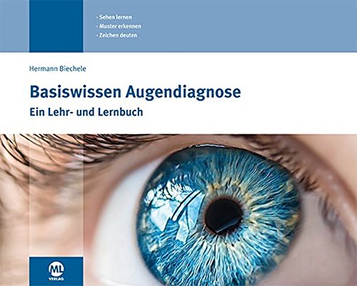 Download Basiswissen Augendiagnose: Ein Lehr- und Lernbuch für die Augendiagnose Download Basiswissen Augendiagnose: Ein Lehr- und Lernbuch für die Augendiagnose