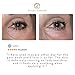 EYE CREAM with Argan Oil, Vitamin E and Caviar Extract- OCEAN D'ARGAN Pearl Eye Gel. Finally get rid of Dark Circles, Wrinkles, Puffiness and Eye Bags. Revolutionary Eye Serum ON SALE NOW - RESULTS GUARANTEED in 15 days. 100% satisfaction or your money back. BUY NOW - RISK FREE