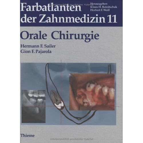 Pdf Farbatlanten Der Zahnmedizin Bd 11 Orale Chirurgie Kostenlos Download Logisch Wissenschaftsbuch Pdf Online
