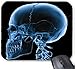 Produktbild Röntgenstrahl-Schädel Rechteckige Mauspad 9,84 x 11,8 Zoll