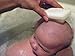 Bean-B-Clean Baby Scalp Massaging Brush For Cradle Cap