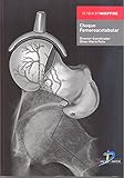 Image de Choque femoroacetabular