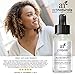 Art Naturals® Anti Acne Serum Treatment 30ml- Dermatologist Tested Product, Made with Revolutionary Evermat® & Organic Ingredients to Help Control & Get Rid of Acne - Best Pore Minimizer -For all Ages
