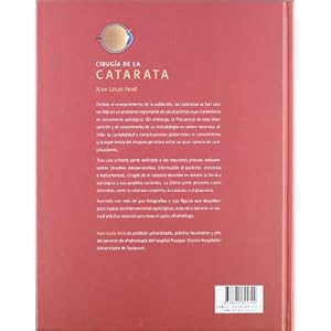 Cirugia de la catarata