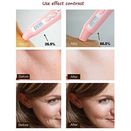 ROMANTIC BEAR Pure 24K Gold Essence Anti Wrinkle Whitening Collagen Moisturizing Hyaluronic Acid Liquid - 5