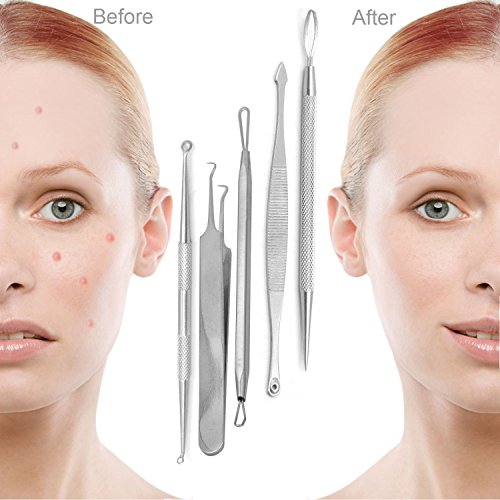 Mitesserentferner, Becoyou 5 Stücke Komedonenquetscher Set aus Edelstahl Nagelhautschieber Werkzeug Professionell Gesundheit Behandlung für Pickel Whiteheads Akne Extraktoren - 7