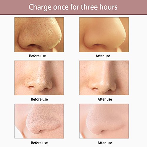 Electric Gesichts Pore Cleanser,Richoose Multifunktions-USB-Massager Gesichtsreiniger Blackhead Akne Entferner Anti Aging Exfoliator zur Förderung der Haut Gesundheit - 6