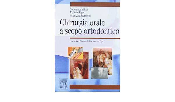 Chirurgia Orale A Scopo Ortodontico Amazon It Annibali Susanna Pippi Roberto Sfasciotti G Luca Libri