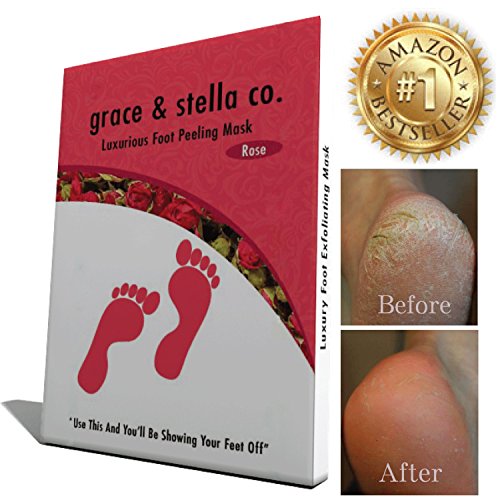 BEST RATED Baby Foot Peeling Mask by Grace & Stella® - Odor Eliminator & Callus Remover - 100% Money-Back Guarantee - Deep Peel Pedicure - Soft Feet Exfoliant Spa Treatment (UK Seller)