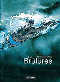 Les  brûlures