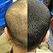 LDN Professional Hair Building Fibres for Hair Loss and Thin Hair, No.1 for Instantly Thickening Hair Naturally, 22g hair fiber bottle