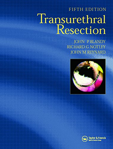 Transurethral Resection Ebook John P Blandy John M Reynard