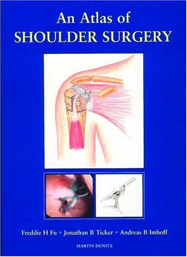 Preisvergleich Produktbild An Atlas of Shoulder Surgery