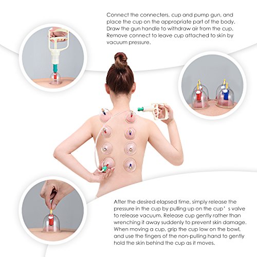 Chinesische Schröpfen Physiotherapie Set bei DigHealth, 12 Schröpfgläser mit Vakuumpumpe und Ventil, Naturheilkunde Selbstbehandlung Massage für Rückenschmerzen, Cellulite, Gesicht, Abnehmen, Bauch - 6